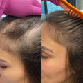 Scalp Micropigmentation Online Course